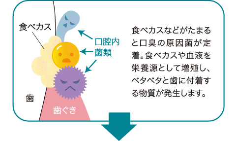 食べカスなどがたまると口臭の原因菌が定着。